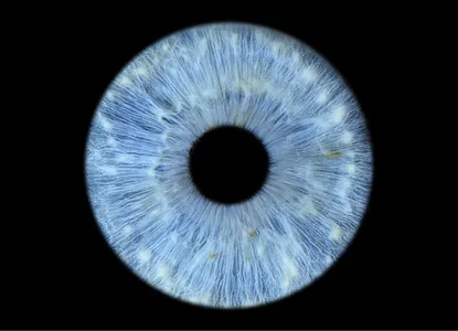 Фото радужки глаза
